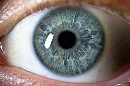 Eye
